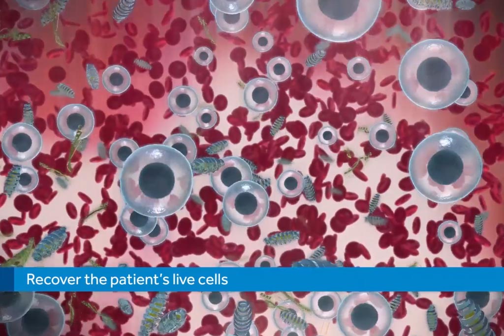 mastergraft by medtronic host cell recovery microscopic detail d medical animation