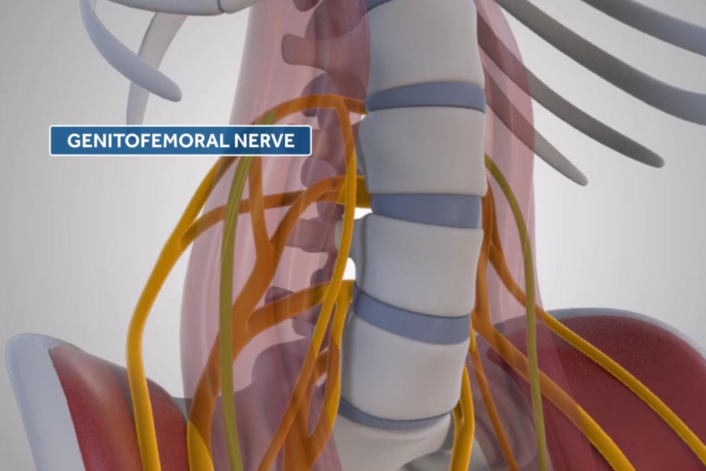 medtronic olif medical animation gentofemoral nerve