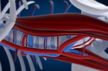 olif procedure by medtronic animation